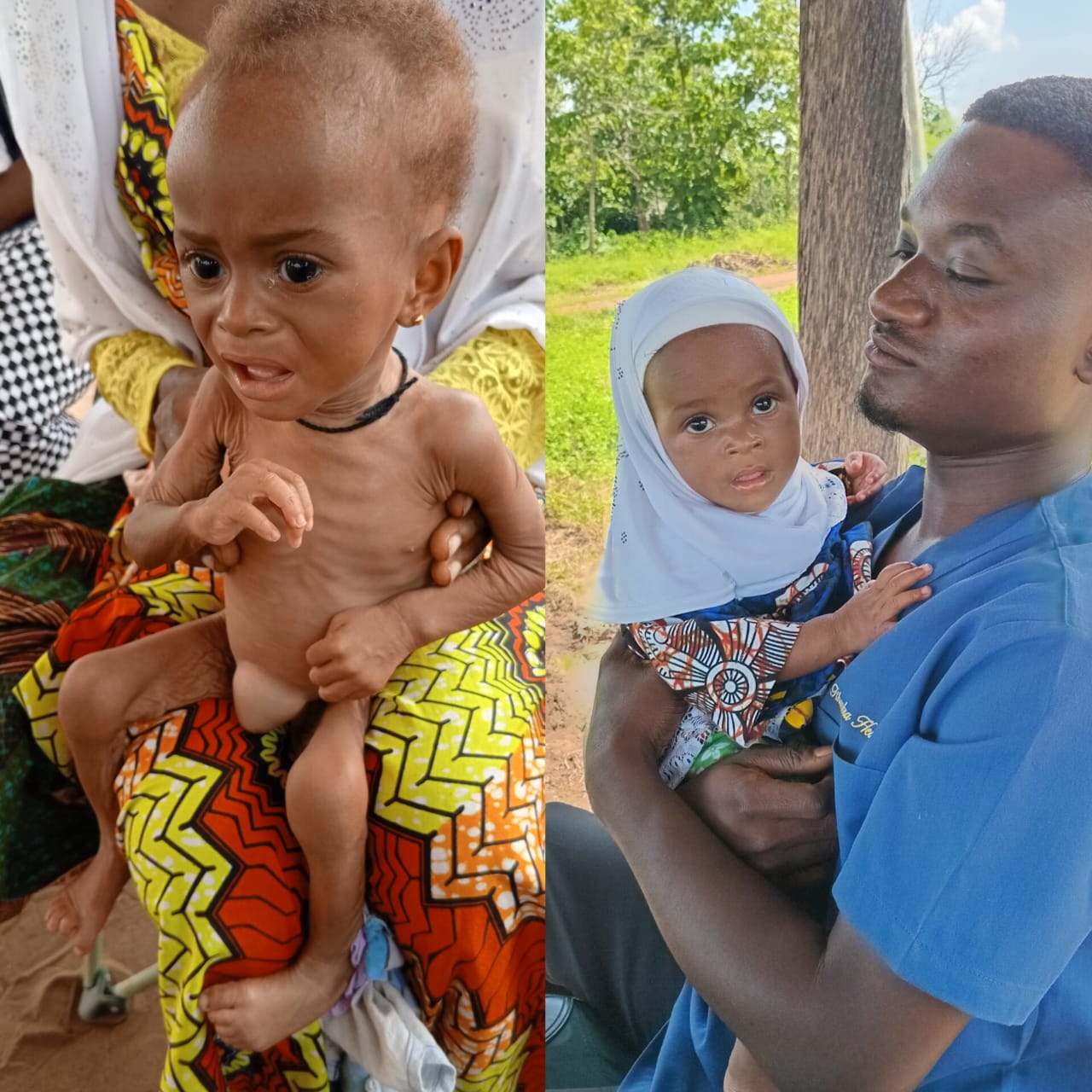 アマ・メンサーちゃん（8か月）の栄養状態改善のビフォーアフター写真